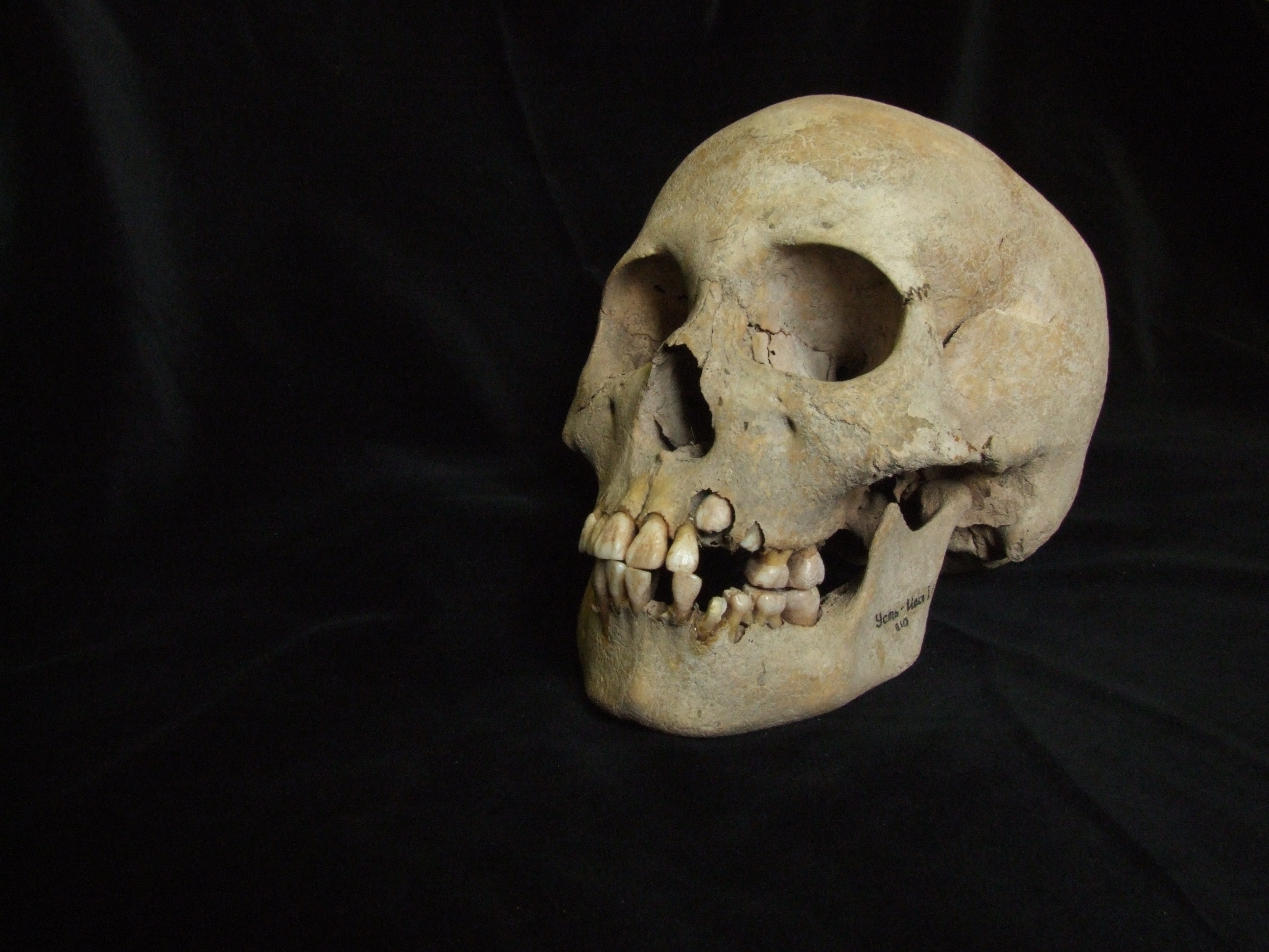 The skull of a 9-11 year old girl who died and was buried along with plague victims at the Ust’Ida I burial ground.